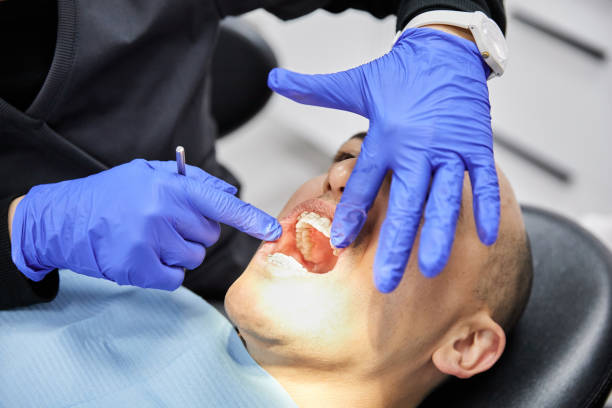 Best Knocked-Out Tooth (Avulsed Tooth) Treatment in Enigma, GA